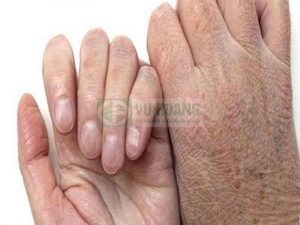 Các hóa chất trong nước giặt tẩy khiến da tay dễ bị khô