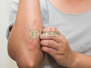 Sự nguy hiểm của axit nitric HNO3