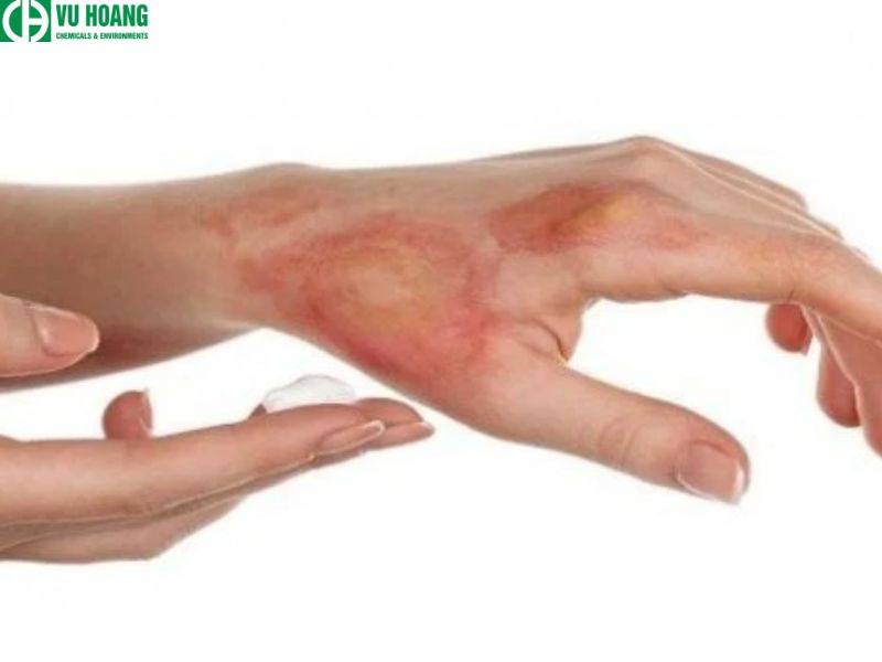 H2o2 Patch Điều cần biết về H2O2 - Hydrogen Peroxide – Công ty TNHH Công nghệ Hóa ...