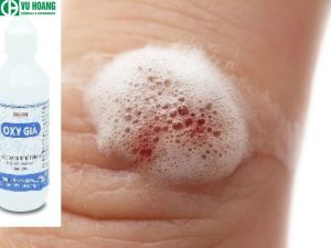 Dùng oxy già rửa vết thương khiến người bệnh cảm thấy đau rát