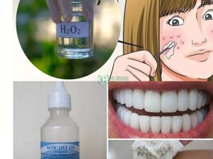 Ứng dụng của Hydrogen Peroxide trong lĩnh vực y tế