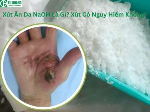 Xút Ăn Da NaOH Là Gì? Xút Có Nguy Hiểm Không?