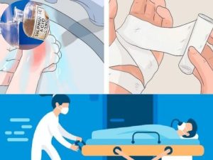 Các bước sơ cứu bỏng h2SO4