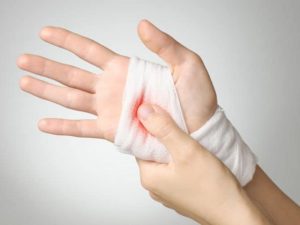 Sơ cứu bỏng do axit