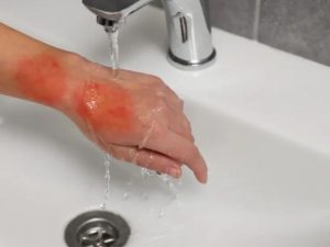 Lưu ý cách pha xút vảy NaOH